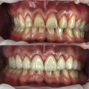 Dr. Pablo Rodrigues - Odontologia Digital E Implantes