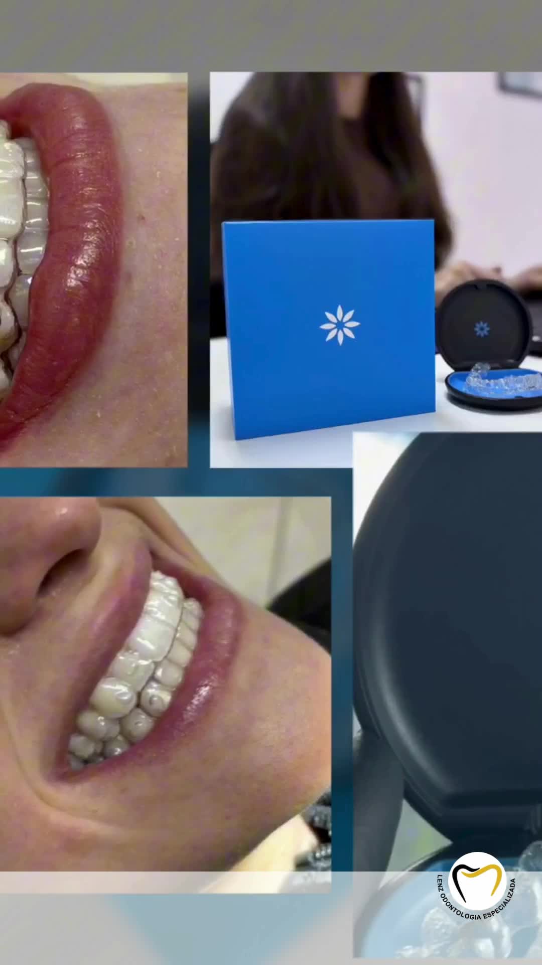 Lenz Odontologia Especializada Dra.Rubia Elisa Lenz CRO-SC 15017