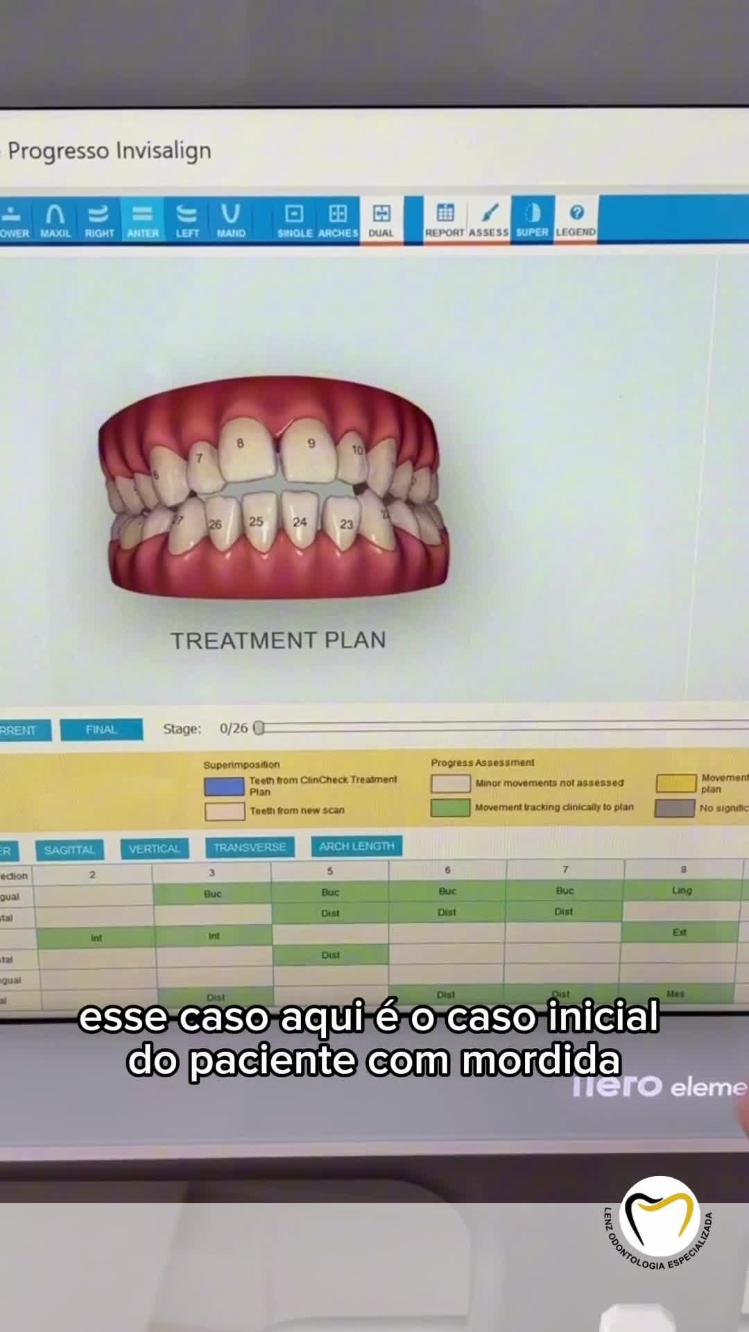 Lenz Odontologia Especializada Dra.Rubia Elisa Lenz CRO-SC 15017