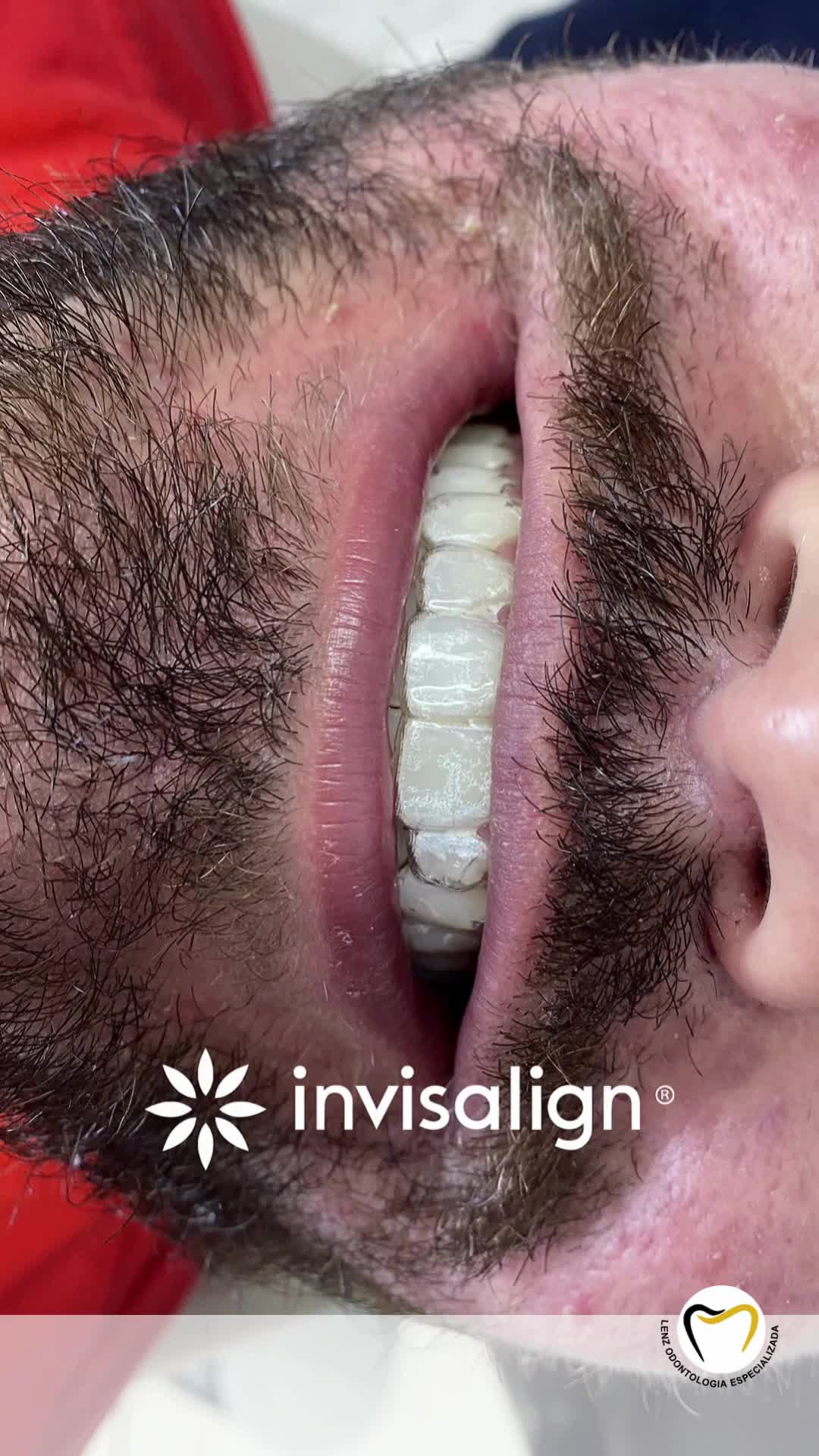 Lenz Odontologia Especializada Dra.Rubia Elisa Lenz CRO-SC 15017