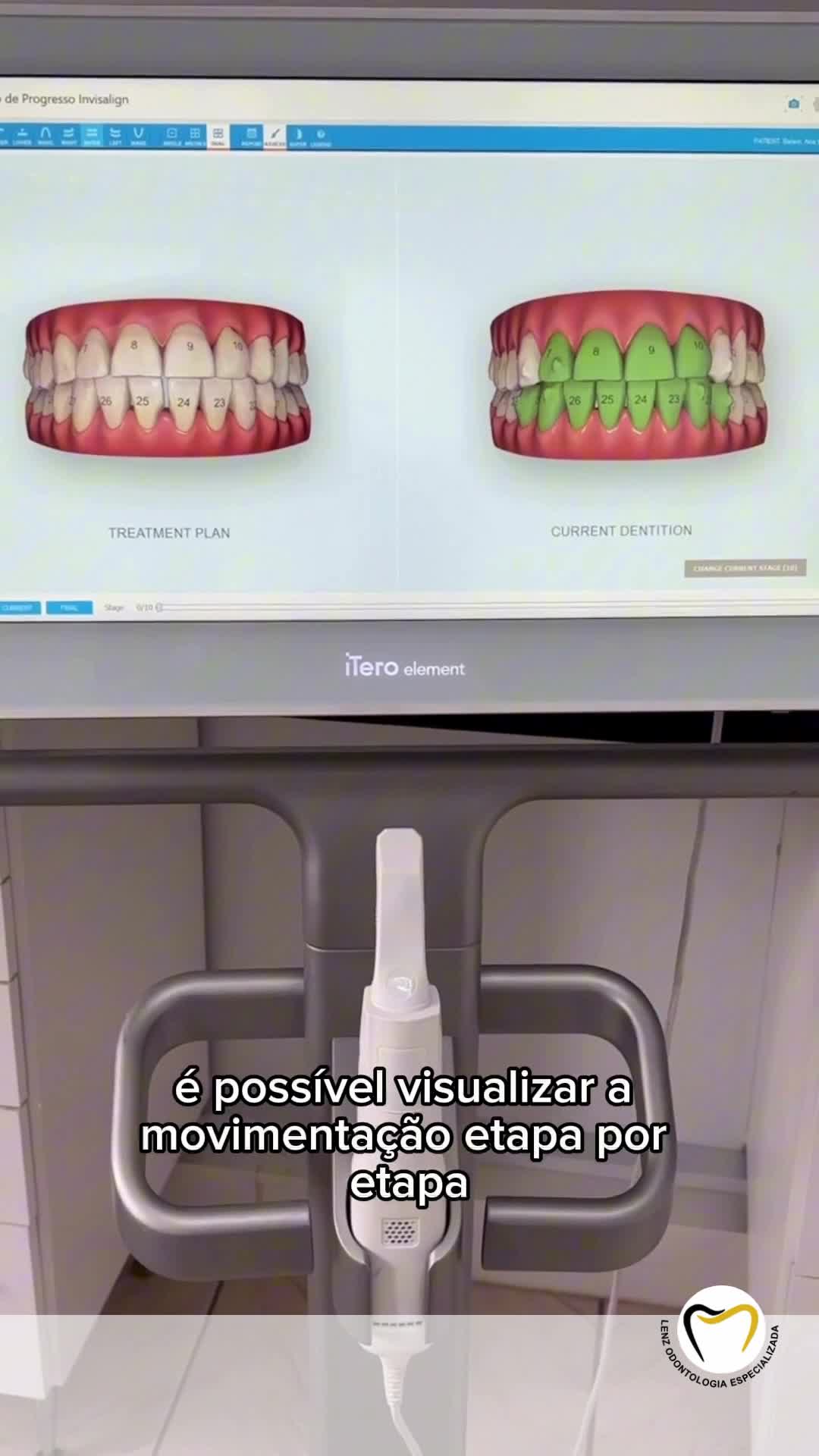 Lenz Odontologia Especializada Dra.Rubia Elisa Lenz CRO-SC 15017