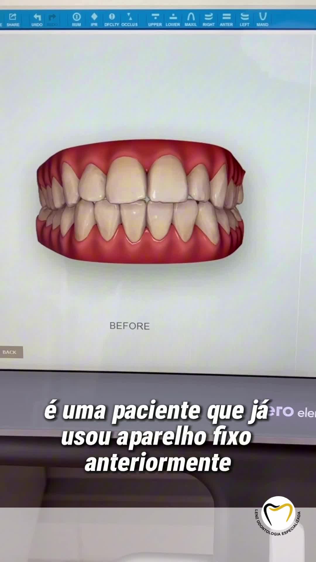 Lenz Odontologia Especializada Dra.Rubia Elisa Lenz CRO-SC 15017